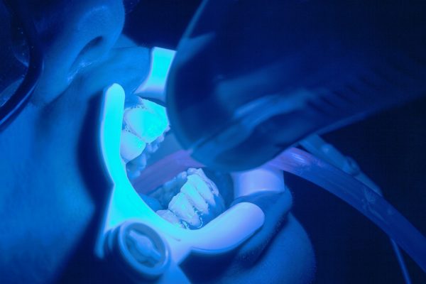 ozkan-guner-5qY2etAevB8-unsplash